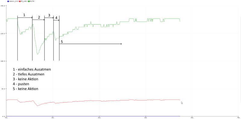 Messwerte der Atemluft, erfasst mit dem Gas Sensor MQ-9